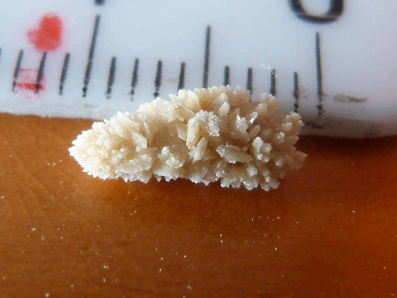Disney Stones: How Alkalisation Can Help Dissolve Uric Acid Kidney Stones